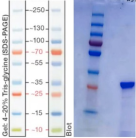 Recombinant Human Mycoplasma Pneumoniae Antigen(his Tag) 