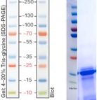 Recombinant Peptidoglycan-associated  Lipoprotein(his Tag)