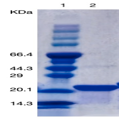 Recombinant Human PTH(39-84aa)/ Parathyroid Hormone Protein (his Tag) 