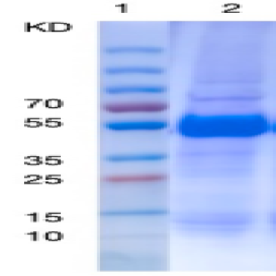 Recombinant Human Intrinsic Factor Protein-2 (his Tag) 