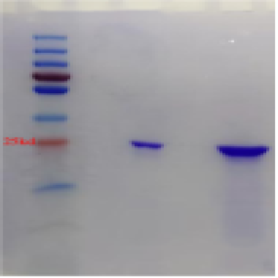 Recombinant KPC(his Tag)