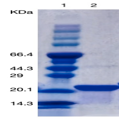 Recombinant Human PTH(1-34aa)/ Parathyroid Hormone Protein (his Tag) 