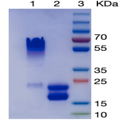 RecombinaHuman TSH alpha & beta Heterodimer Protein (his Tag) 