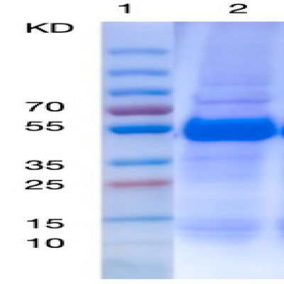 Recombinant Human Intrinsic Factor Protein-3 (his Tag) 