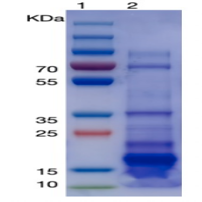 Recombinant Human TSH beta Protein (his Tag) 