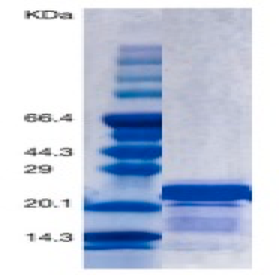 Recombinant Human PTH(1-84aa)/ Parathyroid Hormone Protein (his Tag) 
