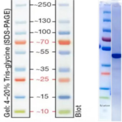 Haemophilus Influenzae Protein D(his Tag)