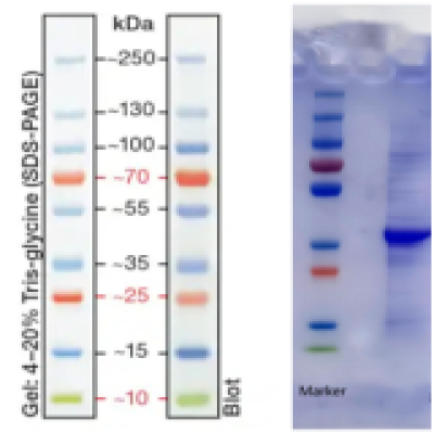 Recombinant Coxsackievirus A6 VP1 Protein(his Tag)