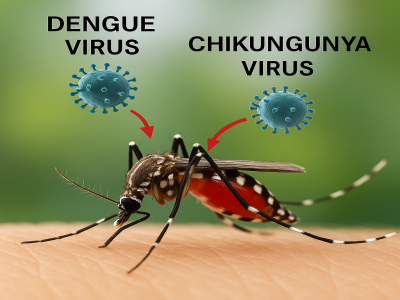 What Is the Difference Between Dengue and Chikungunya?